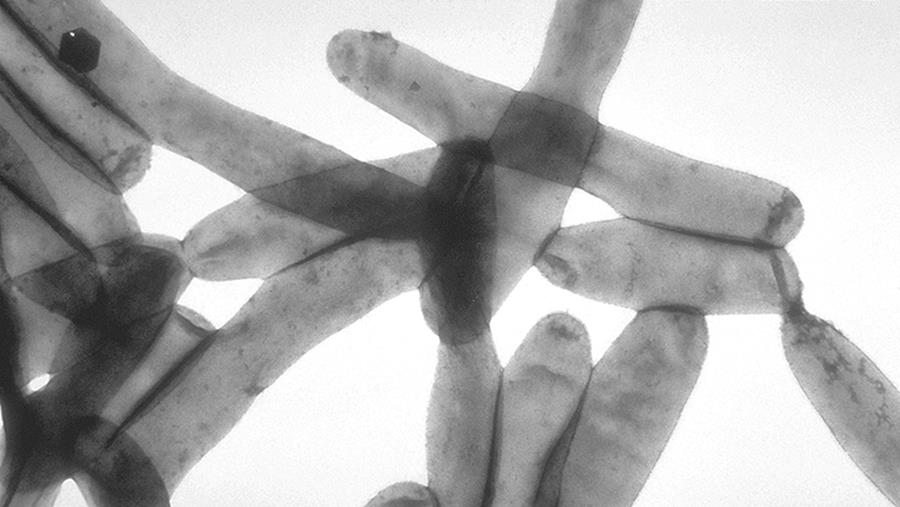 New York : Quatre décès dus à la légionellose