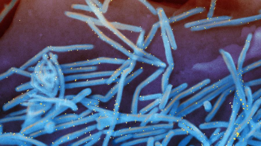 VRS: vers une meilleure prévention pour moins d'hospitalisations